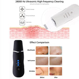 Cleaning Vibrate Deep Face Skin Scrubber